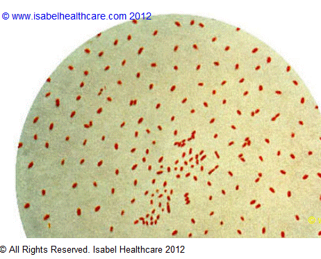 Bordetella pertussis resized 600