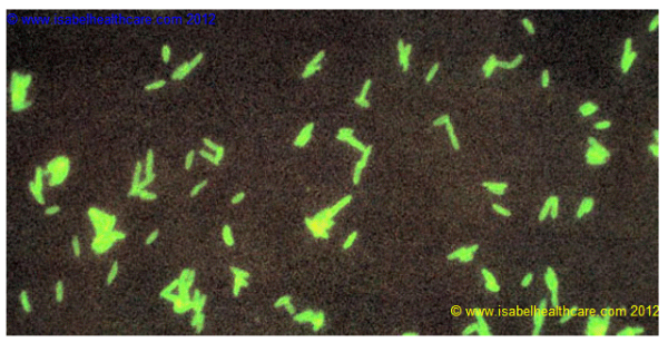 Legionella dye resized 600