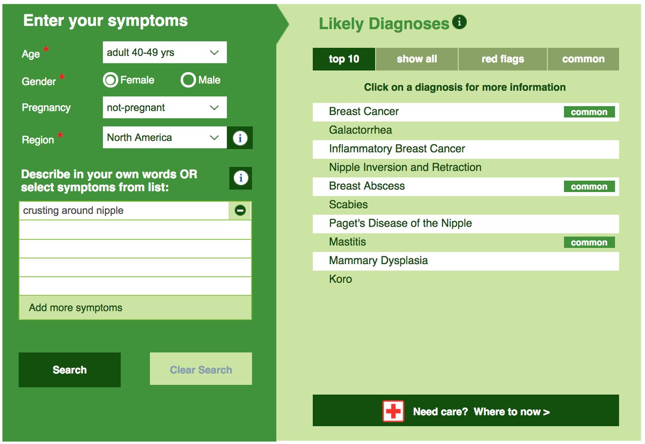 Could I have Breast Cancer? Awareness Month Symptoms